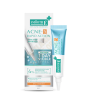 Smooth E Acne-5 Быстрое действие Гель от прыщей  Smooth-E - 10гр.